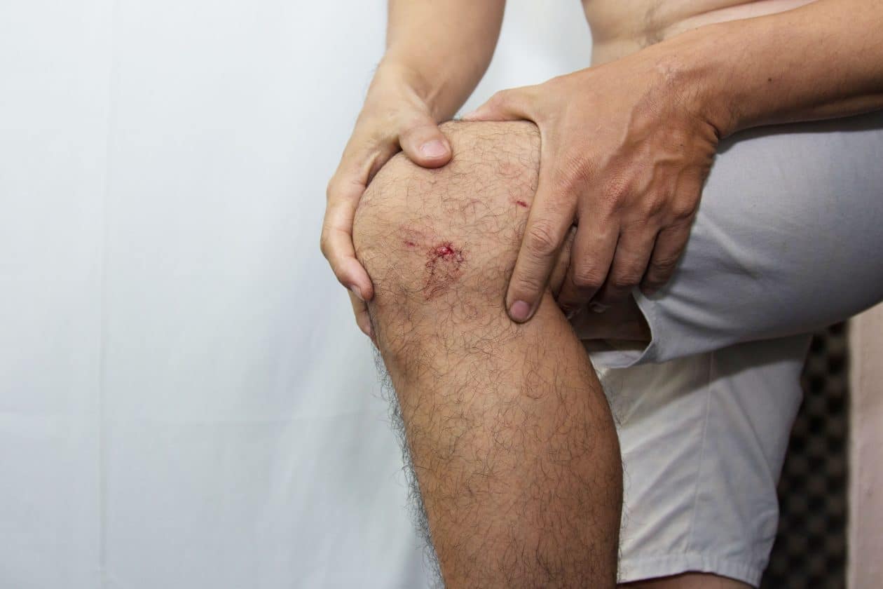 Abogados Expertos En Casos De Lesiones Por Mordeduras De Perros En Fresno